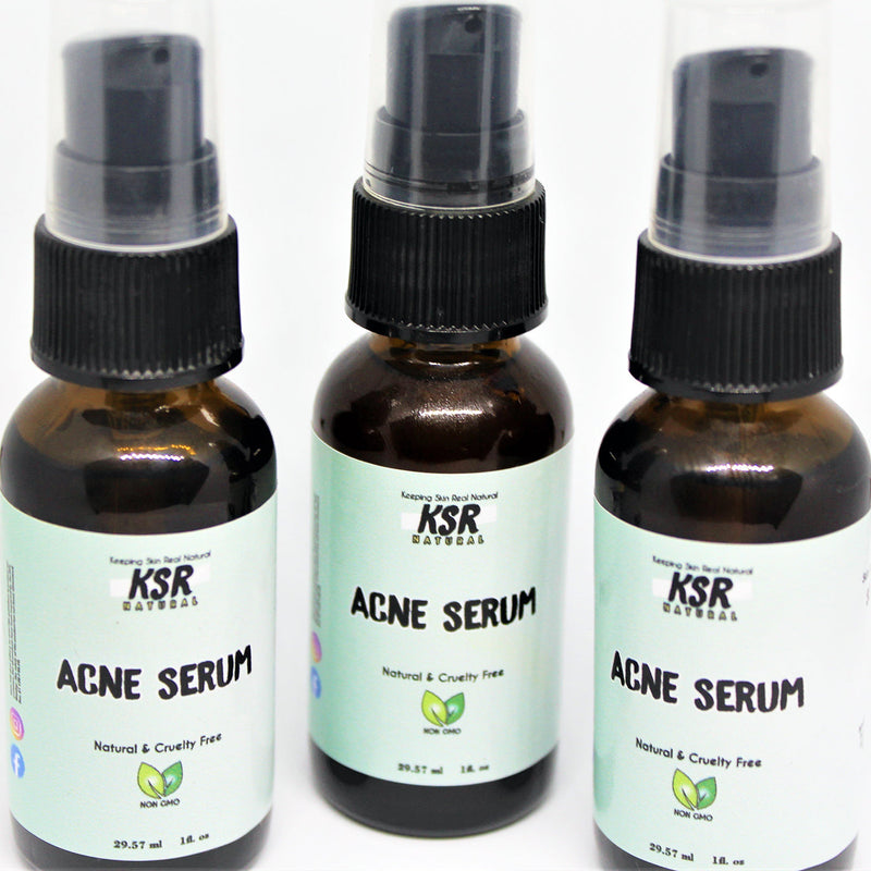 Acne Serum (Acne Out)
