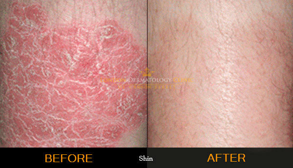 Organic Blackseed Hydrating Cream