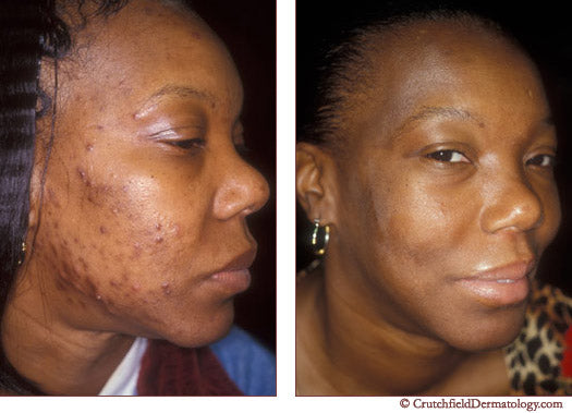 4oz Organic Turmeric Clay Facial Mask/TONING, DARK SPOTS