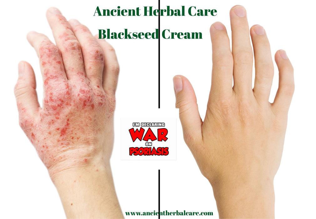 Organic Blackseed Hydrating Cream